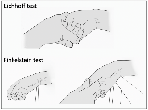 De test van Eichhoff en de test van Finkelstein